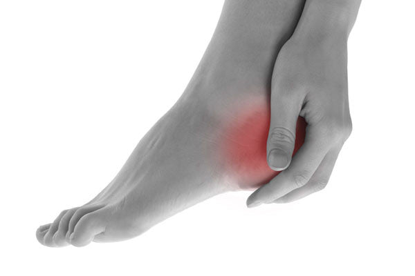 Introduction to heel pain and plantar fasciitis